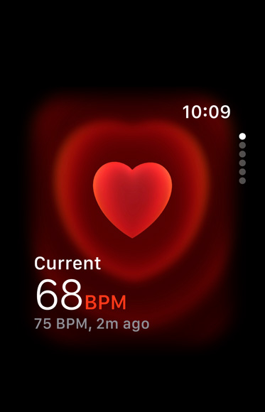 An ECG being taken with the ECG app.